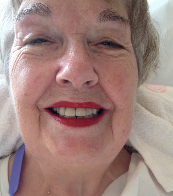 crowns treatment